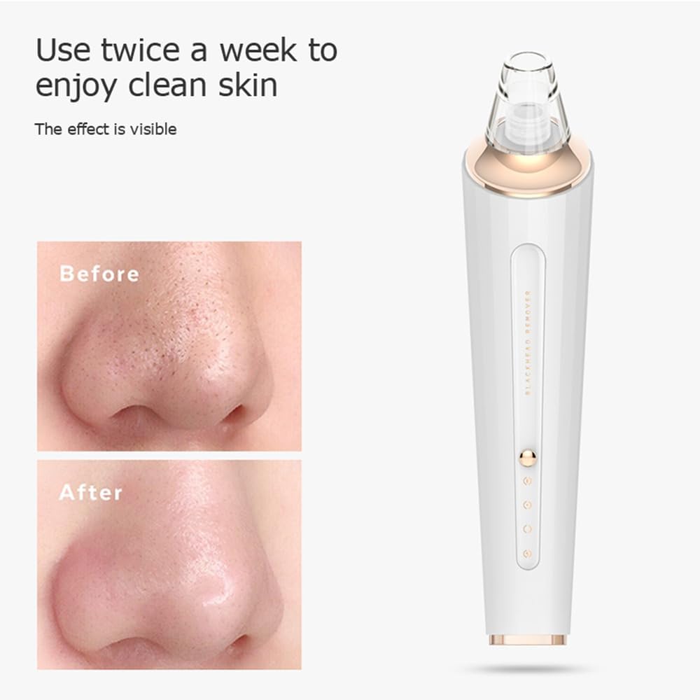 Black Head Remover Tool with 4 Probes & 3 Modes I14450